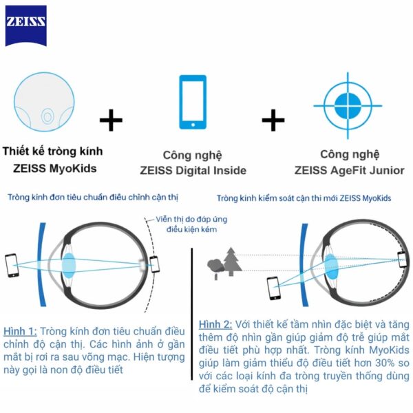 Zeiss MyoKids tròng kính trẻ em