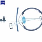 Zeiss MyoKids PhotoFusion X – Tròng Kính Đổi Màu Trẻ Em Kiểm Soát Cận Thị - Ảnh 7