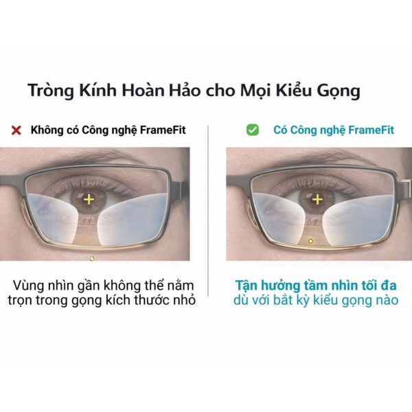 Zeiss Smarrlife Plue Tròng Kính Đa Tròng với Lớp Phủ Cao Cấp DuraVision Gold