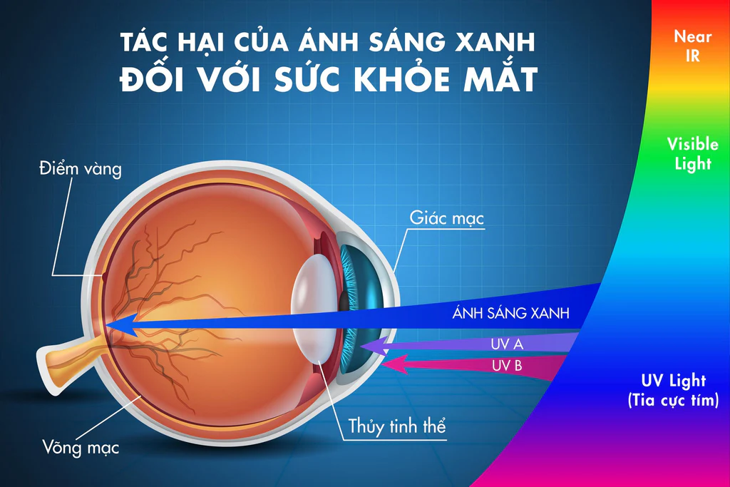 Ánh sáng xanh có phải nguyên nhân chính gây mỏi mắt.