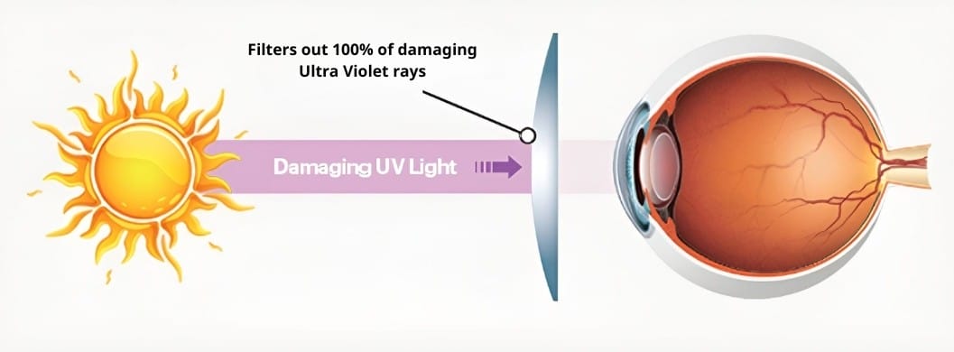 Tròng Kính Kodak 1.74 UVBlue Siêu Mỏng Chống Ánh Sáng Xanh