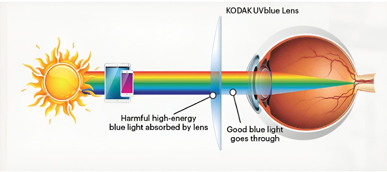 Tròng Kính Kodak 1.74 UVBlue Siêu Mỏng Chống Ánh Sáng Xanh