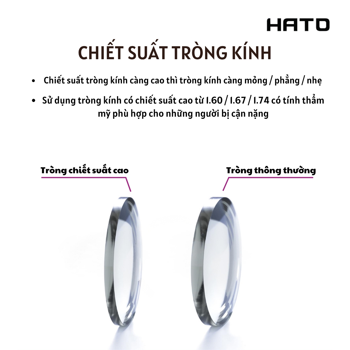 Tròng kính Kodak 1.74 UVBlue siêu mỏng cho người độ cao