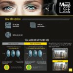 Nikon Myopsee DAS Pure Blue UV Tròng Kính Phi Cầu 2 Mặt Siêu Mỏng