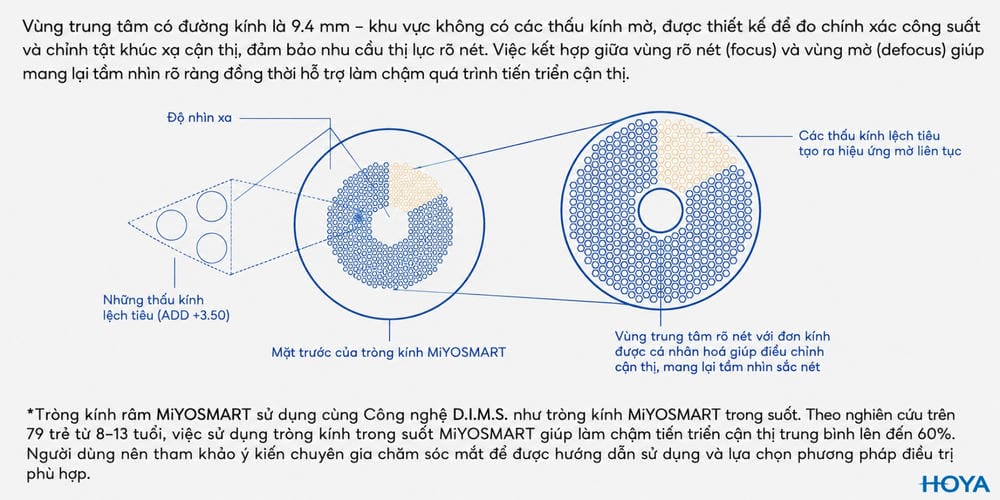 Hoya MiYOSMART 1.59 - 4 Sự Lựa Chọn Phù Hợp Cho Trẻ Em Cận Thị
