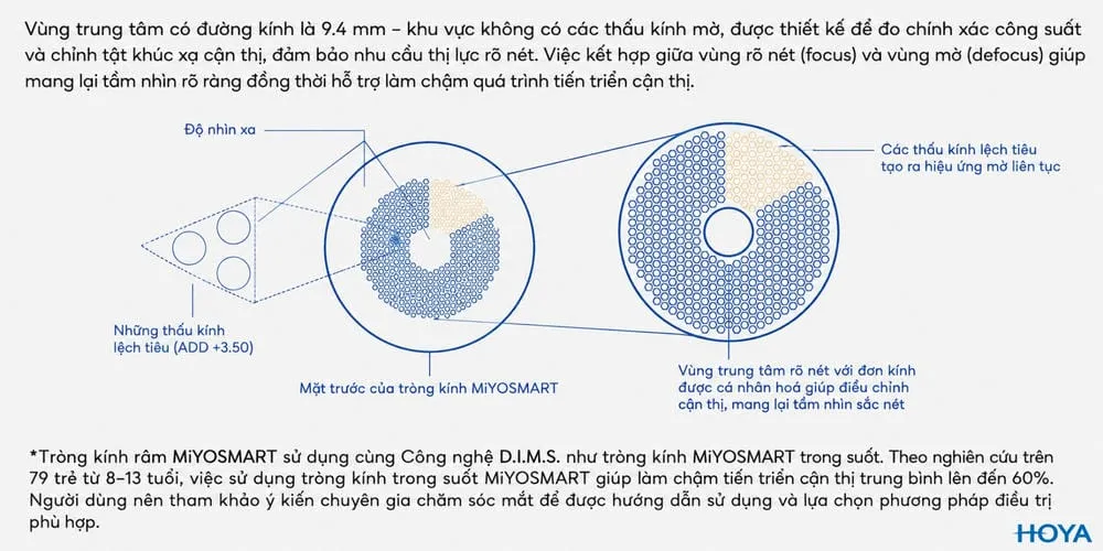 Hoya MiYOSMART 1.59 - 4 Sự Lựa Chọn Phù Hợp Cho Trẻ Em Cận Thị