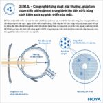 Hoya MiYOSMART – Tròng Kính Kiểm Soát Cận Thị Trẻ Em