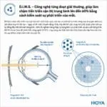Hoya MiYOSMART – Tròng Kính Kiểm Soát Cận Thị Trẻ Em