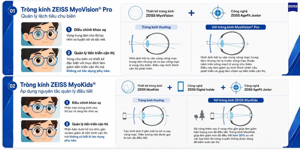 Tròng Kính ZEISS Có Tốt Không? Bảng Giá Và Cách Chọn Phù Hợp