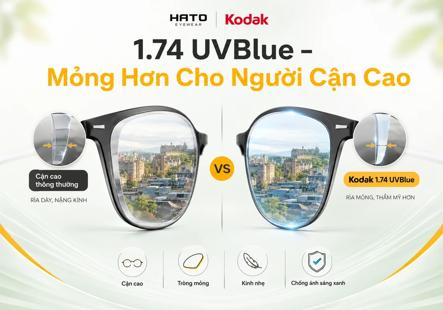 Tròng kính Kodak 1.74 UVBlue mỏng hơn cho người cận cao, so sánh rìa tròng dày và tròng mỏng khi lắp vào gọng kính